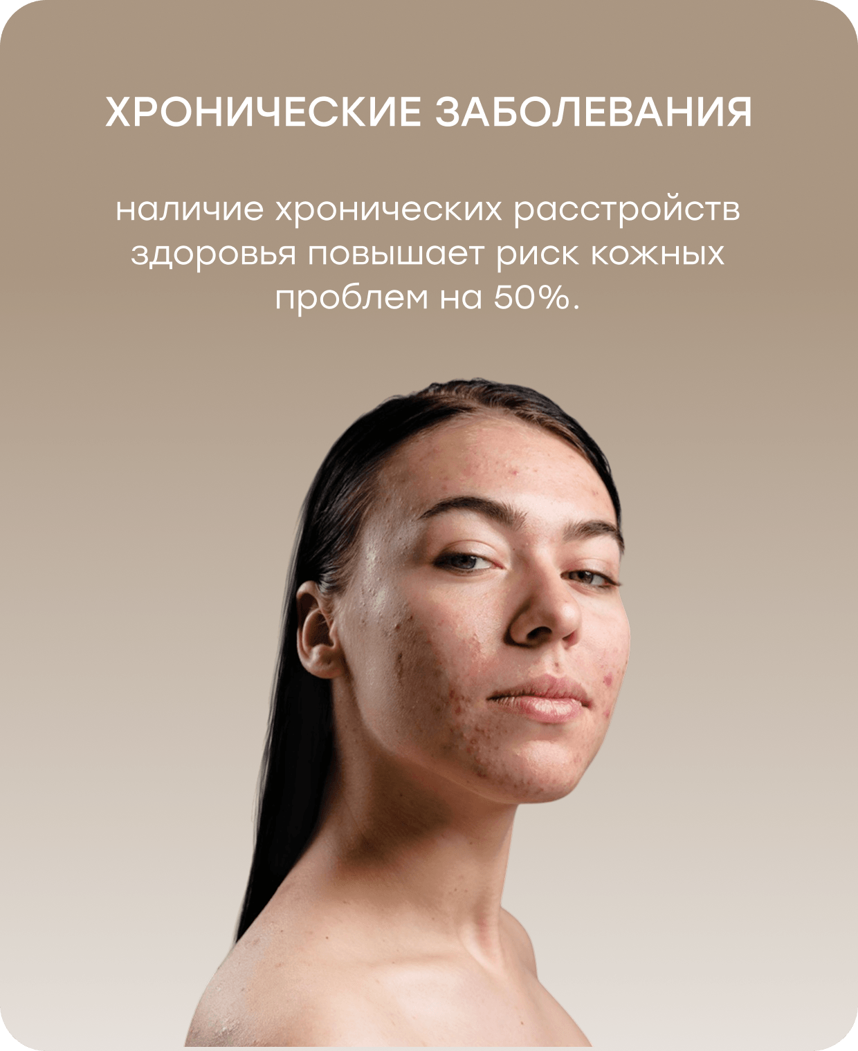 Баннер