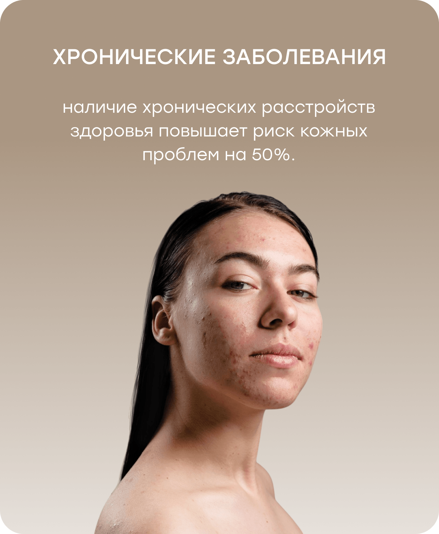 Баннер